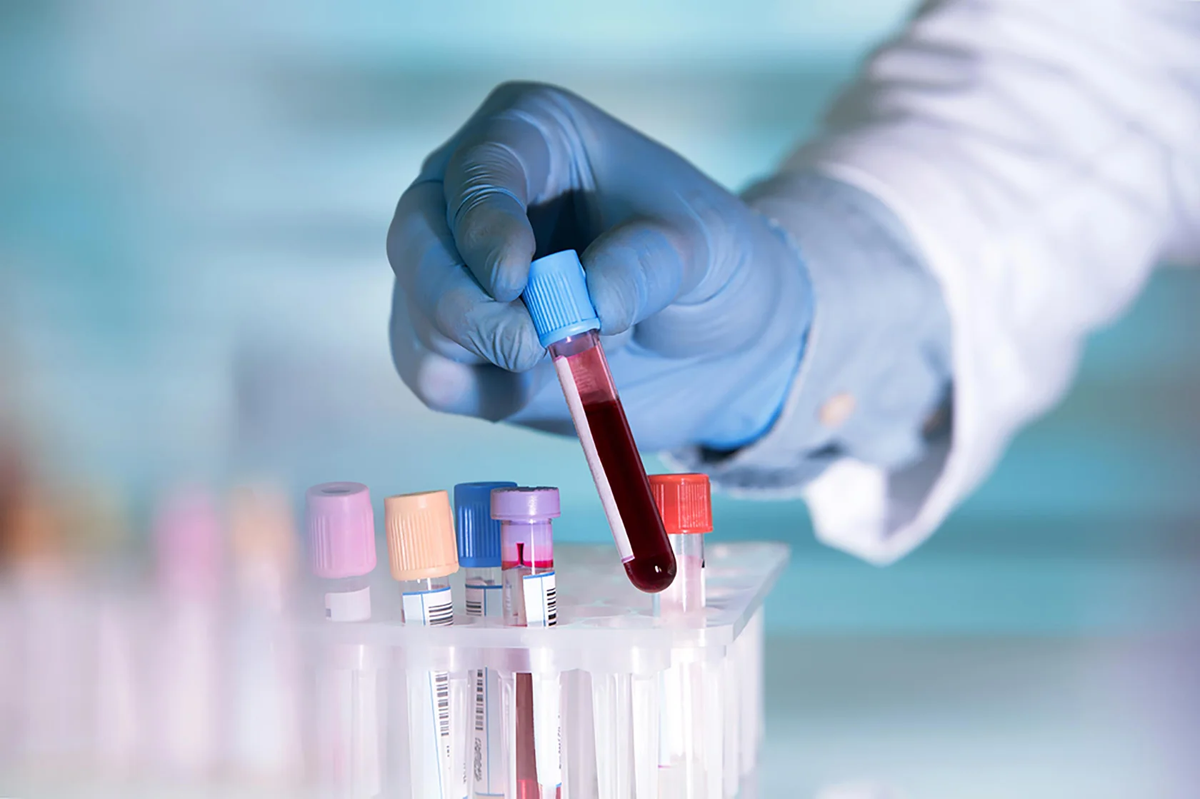 Проведение анализов крови в Ростове-на-Дону